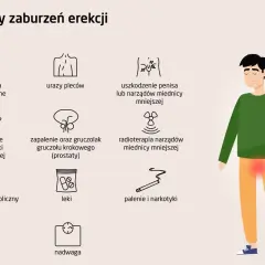 Ilustracja przedstawia przyczyny zaburzeń erekcji: problemy neurologiczne, urazy pleców, uszkodzenia penisa, zaburzenia hormonalne, choroby prostaty, radioterapię, zespół metaboliczny, leki, palenie i narkotyki, nadwagę.
