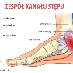 Ilustracja pokazuje anatomię stopy i łydki, wyjaśniając przyczyny mrowienia w stopach od kręgosłupa. Widoczne nerwy i kości.