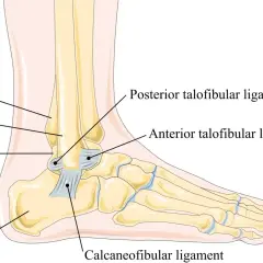 Anatomia stawu skokowego: tibia, fibula, talus, calcaneus i więzadła: anterior talofibular, posterior talofibular, calcaneofibular poniżej stawu skokowego.