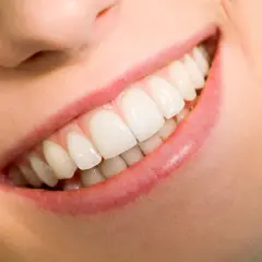 Uśmiech po zabiegu gingiwektomii. Piękne, białe zęby i zdrowe dziąsła.