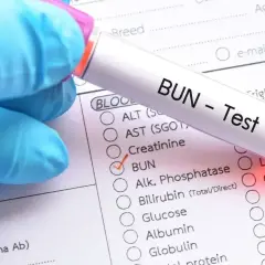 Rękawiczka medyczna trzyma probówkę z napisem "BUN - Test". Zaznaczono pozycję "BUN" na formularzu, co sugeruje badanie mocznika we krwi.