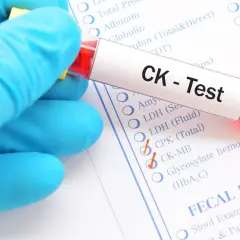 Rękawiczka trzyma probówkę z krwią do testu CK. Na formularzu zaznaczono kinazę kreatynową (CK-MB).