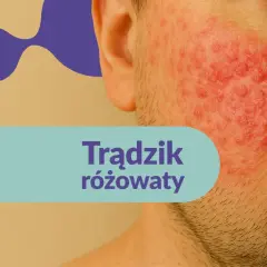 Skóra twarzy z widocznymi zmianami zapalnymi, zaczerwienieniem i grudkami. Tekst: "Trądzik różowaty". Poznaj przyczyny trądziku różowatego.