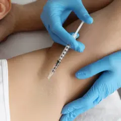 En person får botox mot svett i armhålan. En spruta injicerar vätska under huden.