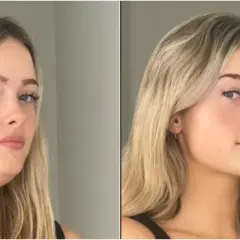 Comparación de antes y después de una mujer. A la izquierda, se ve un doble mentón. A la derecha, tras aplicar la técnica de **que es mewing**, su mandíbula luce más definida.