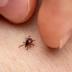 Cómo quitar garrapata de forma segura y evitar infecciones peligrosas