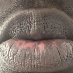 Labios agrietados y con manchas, evidencia de manchas en los labios por fumar.