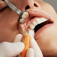 Dentysta bada zęby pacjenta. Zastanawiasz się, ile trwa wyrywanie zęba 6?