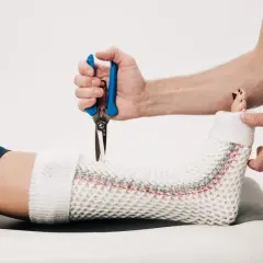 Lekarz zdejmuje gips z nogi pacjenta, przygotowując do zmiany na ortezę. Pytanie: po jakim czasie można zmienić gips na ortezę?