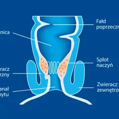Schemat przedstawia budowę odbytnicy, kanału odbytu, zwieraczy i splotu naczyniowego. Ilustracja może pomóc zrozumieć mechanizm wypadania odbytu.
