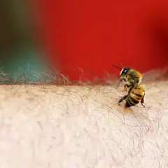 Jakie leki na użądlenie pszczoły? Szybka ulga i kiedy do lekarza?