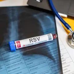 Test RSV z zaznaczonym wynikiem "POSITIVE" leży na zdjęciu rentgenowskim klatki piersiowej. Obok stetoskop.
