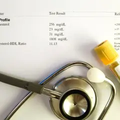 Wynik lipidogramu, probówka z krwią i stetoskop.