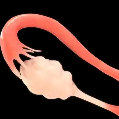 Anatomia kobieca: jajniki i jajowód. Jasnoróżowy jajnik otoczony strzępkami jajowodu.