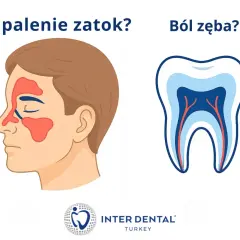 Zapalenie zatok czy ostry ból zęba? Ilustracja porównuje objawy zapalenia zatok z przekrojem zęba, sugerując, że ból może być mylący.