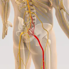 Anatomia układu nerwowego z zaznaczonym na czerwono nerwem, który może być objęty stenoza.