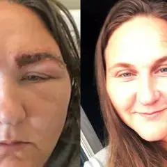 Henna do brwi na skórze? Ryzyko poparzeń i alergii na PPD!