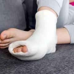 Dziecko z krzywą ręką po zdjęciu gipsu, stopa w opatrunku.