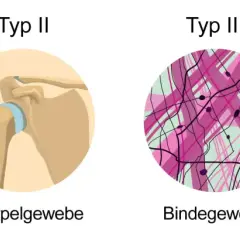 Kollagen ist ein wichtiges Protein. Die Grafik zeigt Typen von Kollagen in Knochen, Haut, Knorpel, Bindegewebe und Basalmembranen.