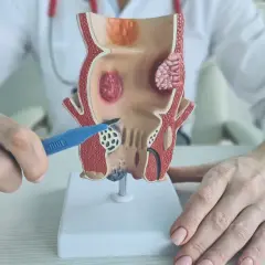 Proktolog: Kiedy zbadać odbyt? Objawy i przygotowanie