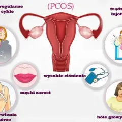 PCO syndrom co to jest - objawy, diagnoza i skutki zdrowotne