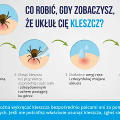 Instrukcja usuwania kleszcza. Pamiętaj, że kleszcz może wejść do ucha, ale ta metoda pomoże go usunąć.