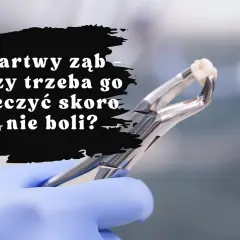 Bolący ząb? Natychmiastowa ulga i sygnały, by iść do dentysty.