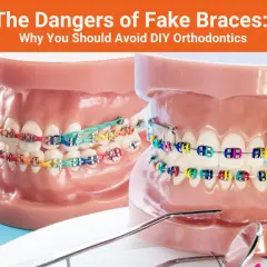 Fake braces: Jak zrobić i dlaczego to zły pomysł?