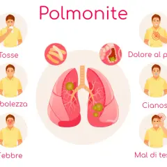 Polmonite: tosse, debolezza, febbre, dolore al petto, cianosi, mal di testa. L'immagine illustra i sintomi della polmonite, inclusa la polmonite ab ingestis.