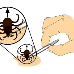 Cómo matar una garrapata de forma segura y evitar infecciones