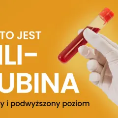 Co to jest bilirubina? Normy i podwyższony poziom. Ręka w rękawiczce trzyma probówkę z krwią.