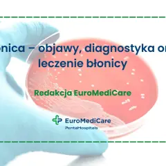 Błonica: objawy, diagnostyka i leczenie. Badanie laboratoryjne w szalce Petriego.