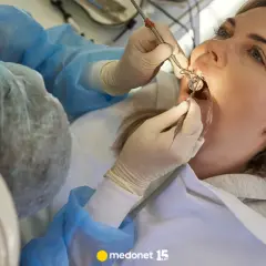 Dentysta na NFZ: Znieczulenie bezpłatne czy płatne? Rozwiewam wątpliwości
