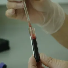 Rękawiczki ochronne i pipeta z krwią w probówce. P-lcr - analiza laboratoryjna.