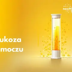 Badanie poziomu glukozy w moczu. Kolba z żółtym płynem i pęcherzykami, symbolizująca analizę.