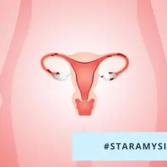 Ilustracja przedstawia tyłozgięcie macicy, które może wpływać na starania o dziecko.