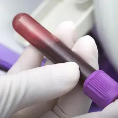 Ręka w białej rękawiczce trzyma probówkę z krwią. Badanie poziomu lipazy jest kluczowe.