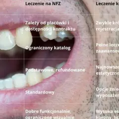 Które zęby można leczyć na nfz? Sprawdź, co obejmuje refundacja