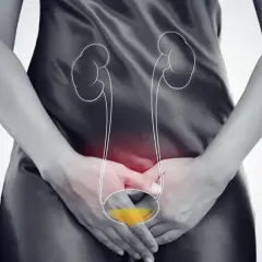 Kobieta z bólem w podbrzuszu, gdzie zaznaczono układ moczowy. Nefrostomia nie leci mocz, co sugeruje problem z odpływem.