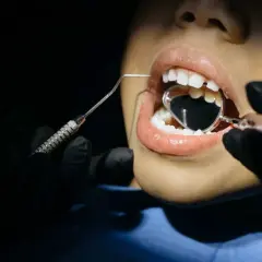 Boca abierta con espejo dental y explorador. ¿Se me rompen las muelas? Significa que es hora de visitar al dentista.