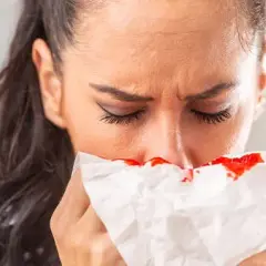 Krwawienia z nosa przyczyna: najczęstsze powody i jak im zapobiegać