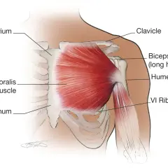 Anatomia klatki piersiowej: widoczny mięsień mostkowy (pectoralis major muscle), obojczyk, rękojeść mostka, żebro VI i kość ramienna.