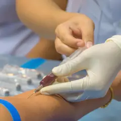Zaburzenia hemostazy: objawy skaz krwotocznych i nadkrzepliwości