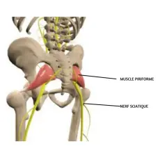 Anatomie du bassin montrant le muscle piriforme et le nerf sciatique, souvent impliqués dans le syndrome du piriforme.
