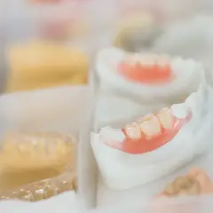Protesi mobile inferiore in fase di lavorazione. Si osservano i denti artificiali e la base rosa, pronti per risolvere i problemi di masticazione.