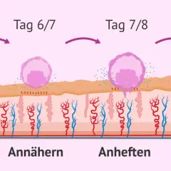 Was passiert nach dem Eisprung: Ein Embryo schlüpft, nähert sich, heftet sich an und dringt in die Gebärmutterschleimhaut ein.