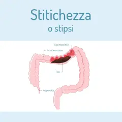 Illustrazione del colon con feci accumulate e gas intestinali, che indica stitichezza. Una purga intestinale potrebbe aiutare.