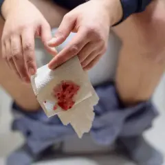 Dłoń trzymająca papier toaletowy z widoczną krwią. To niepokojący objaw, który może wskazywać na krew w stolcu.