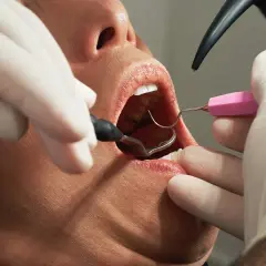 Dentysta na NFZ: Co naprawdę przysługuje Ci za darmo? Sprawdź!