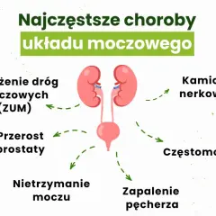 Przyczyny zapalenia pęcherza moczowego: co musisz wiedzieć, aby uniknąć problemów